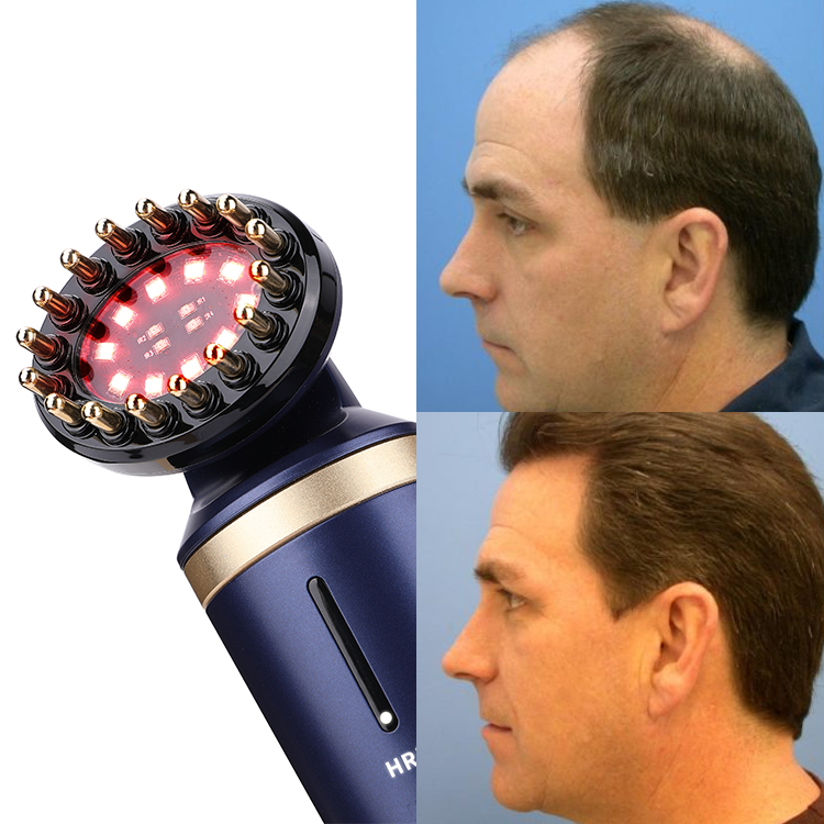 Инфракрасная расческа для роста волос с функциями EMS RF и LED-терапии 6