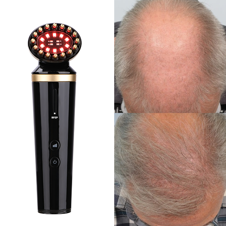 Инфракрасная расческа для роста волос с функциями EMS RF и LED-терапии 7